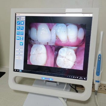 YF-1700P+ Cámara intraoral dental pantalla táctil de 17 pulgadas para unidad dental con soporte