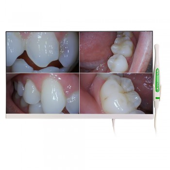 Magenta YF-2400M Cámara intraoral dental Wifi con monitor de 24 pulgadas y soporte de hierro
