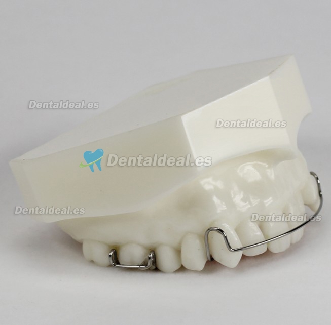 Orthodontic Demonstration Modelo Para Maintenance M3007