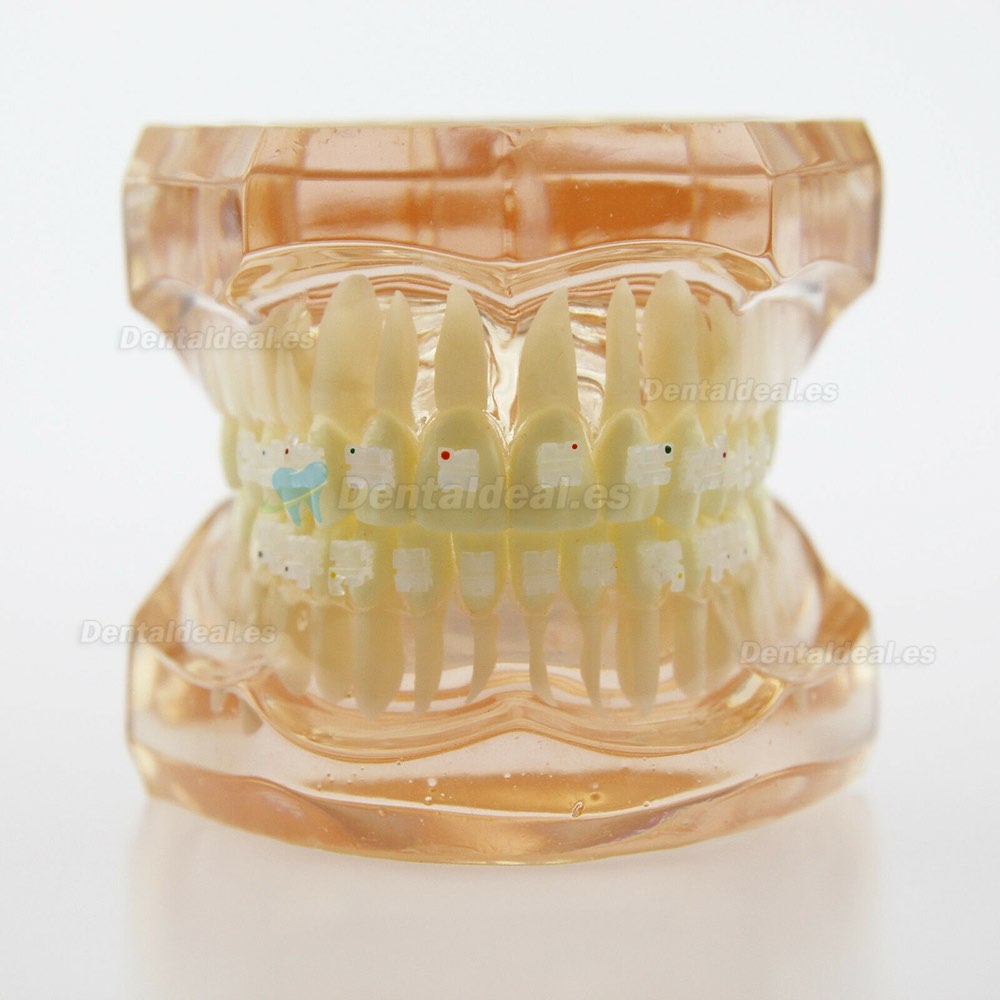 Modelo de Tratamiento de Ortodoncia Dental Dientes de Demostración con Soporte de Cerámica #3002