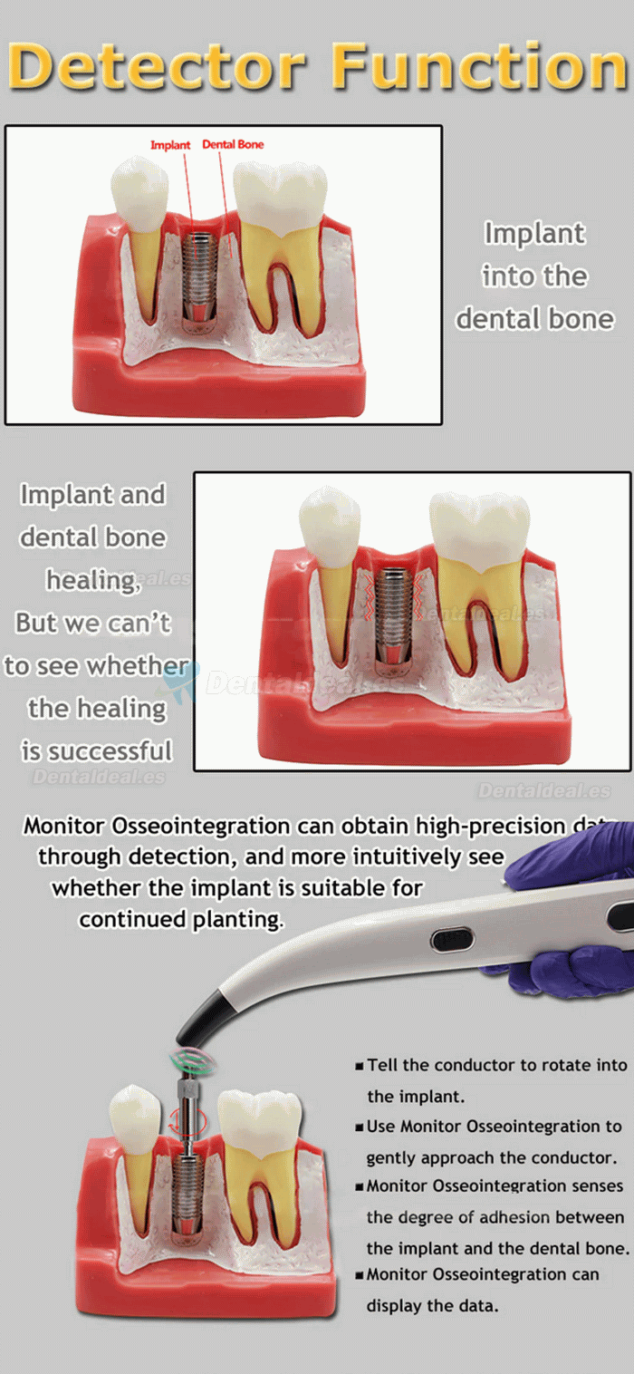 Probador de monitor de estabilidad de implantes Dental ISQ dispositivo de medición del medidor de estabilidad del implante
