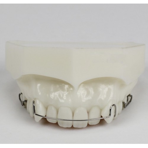 Orthodontic Demonstration Modelo Para Maintenance M3007