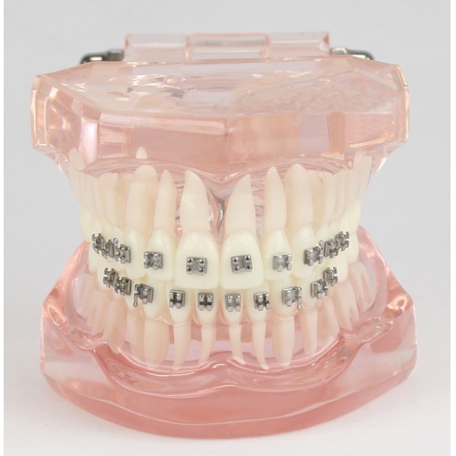 Modelo de Tratamiento de Ortodoncia Dental Dientes de Demostración con Soporte de Metal #3001