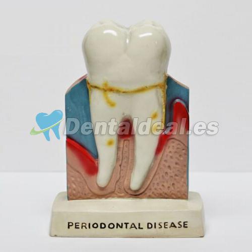 Los dientes dentales Oral Figura Anatomía Enseñanza Permanente de la decoración
