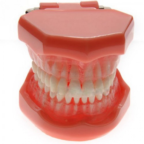 Dental Dientes de enfermedad del implante dental Modelo extraíble Enseñanza para adultos # 7005