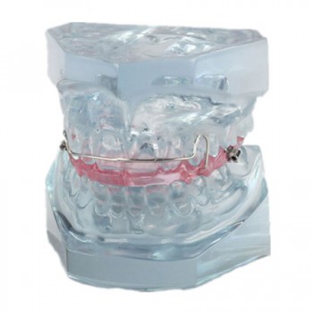 Modelo de restricción después del tratamiento de ortodoncia M-3006