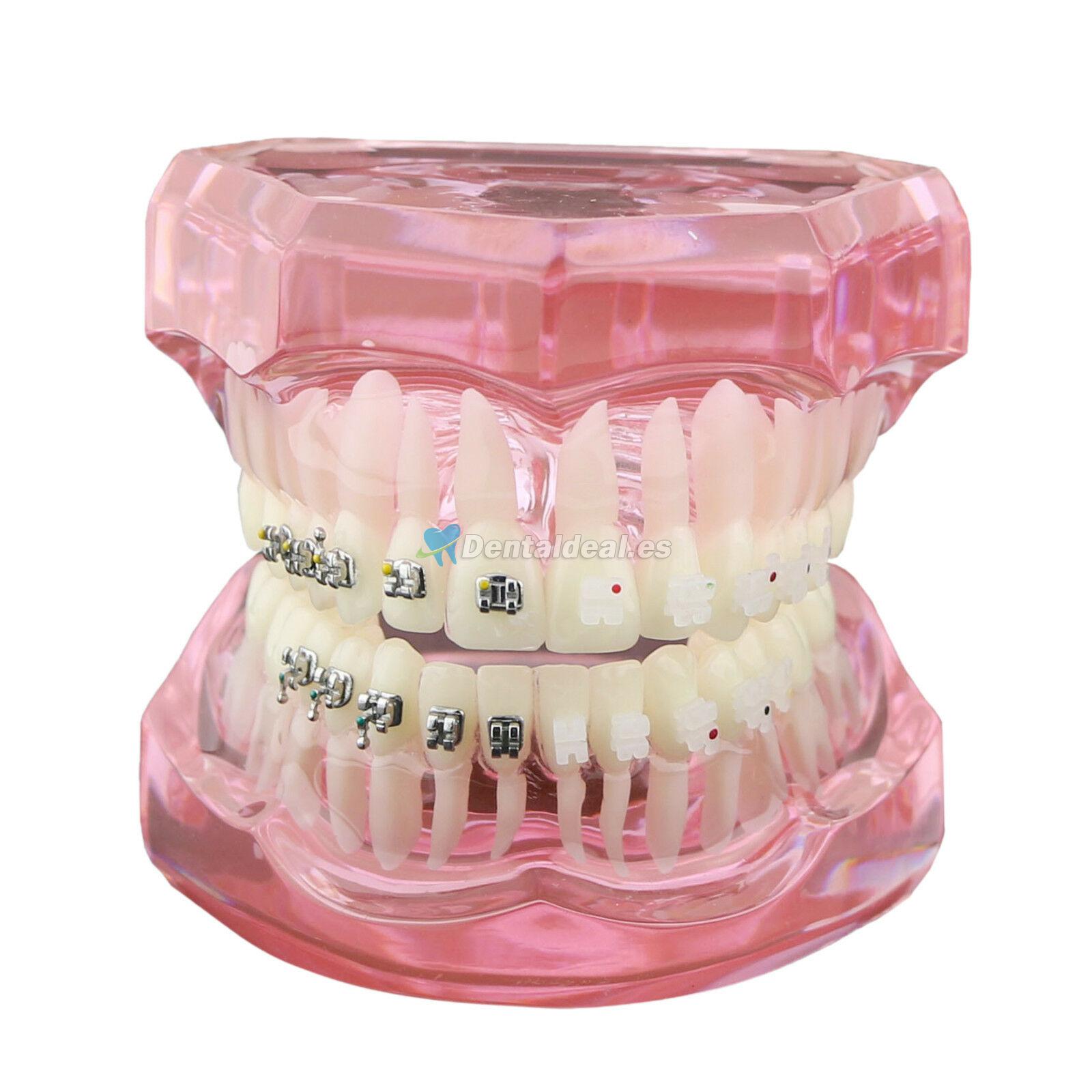 Dientes de ortodoncia dental Modelo de metal y soporte de cerámica Braces estudio modelo 3003