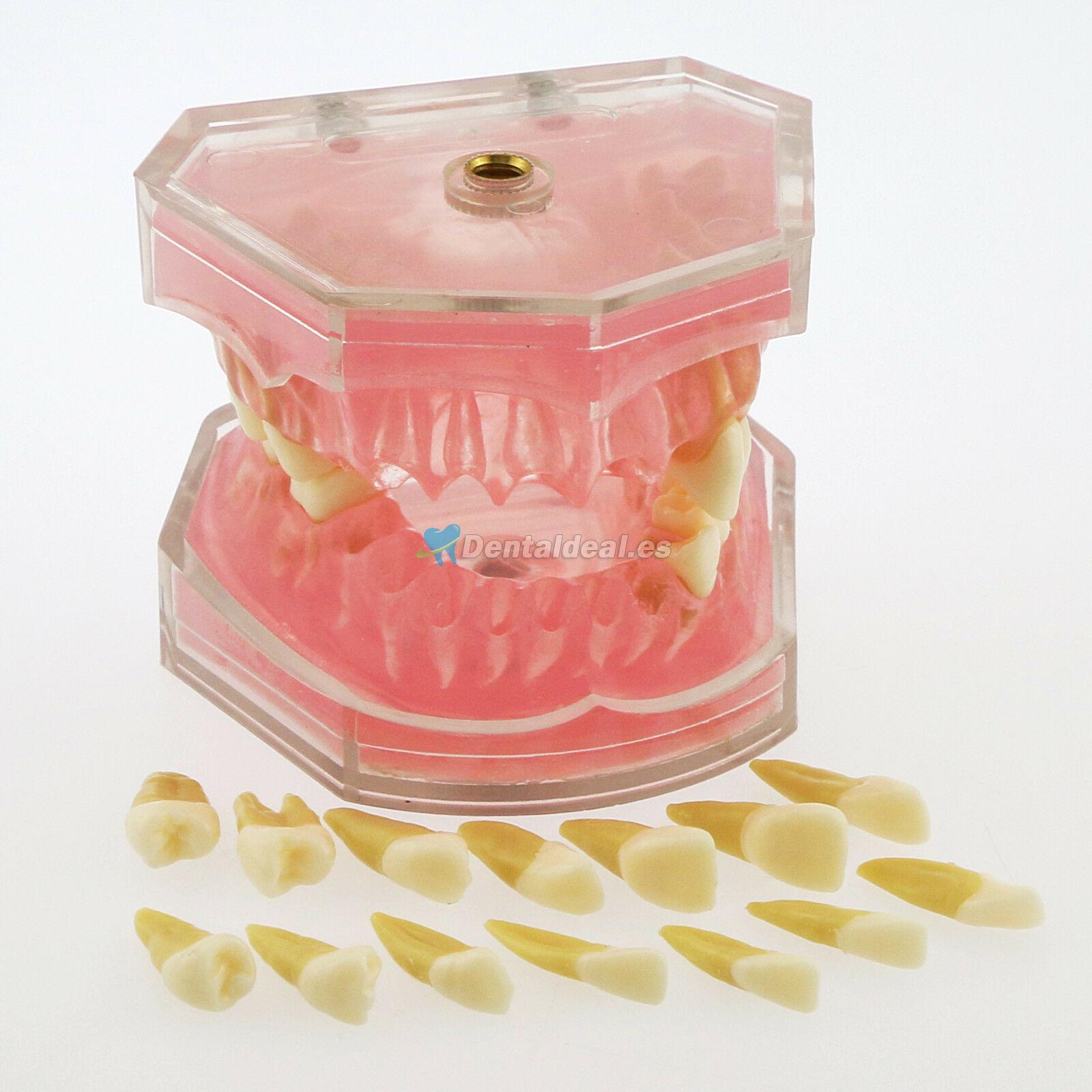 28 Pcs Modelo de enseñanza estándar del estudio del modelo de dientes de dientes extraíbles de dientes 4004