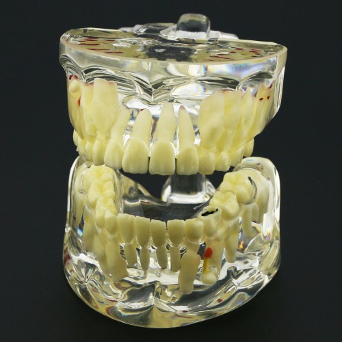 Modelo de Estudio de Demostración de Patología Pediátrica de Dientes de Niños Dentales 4002