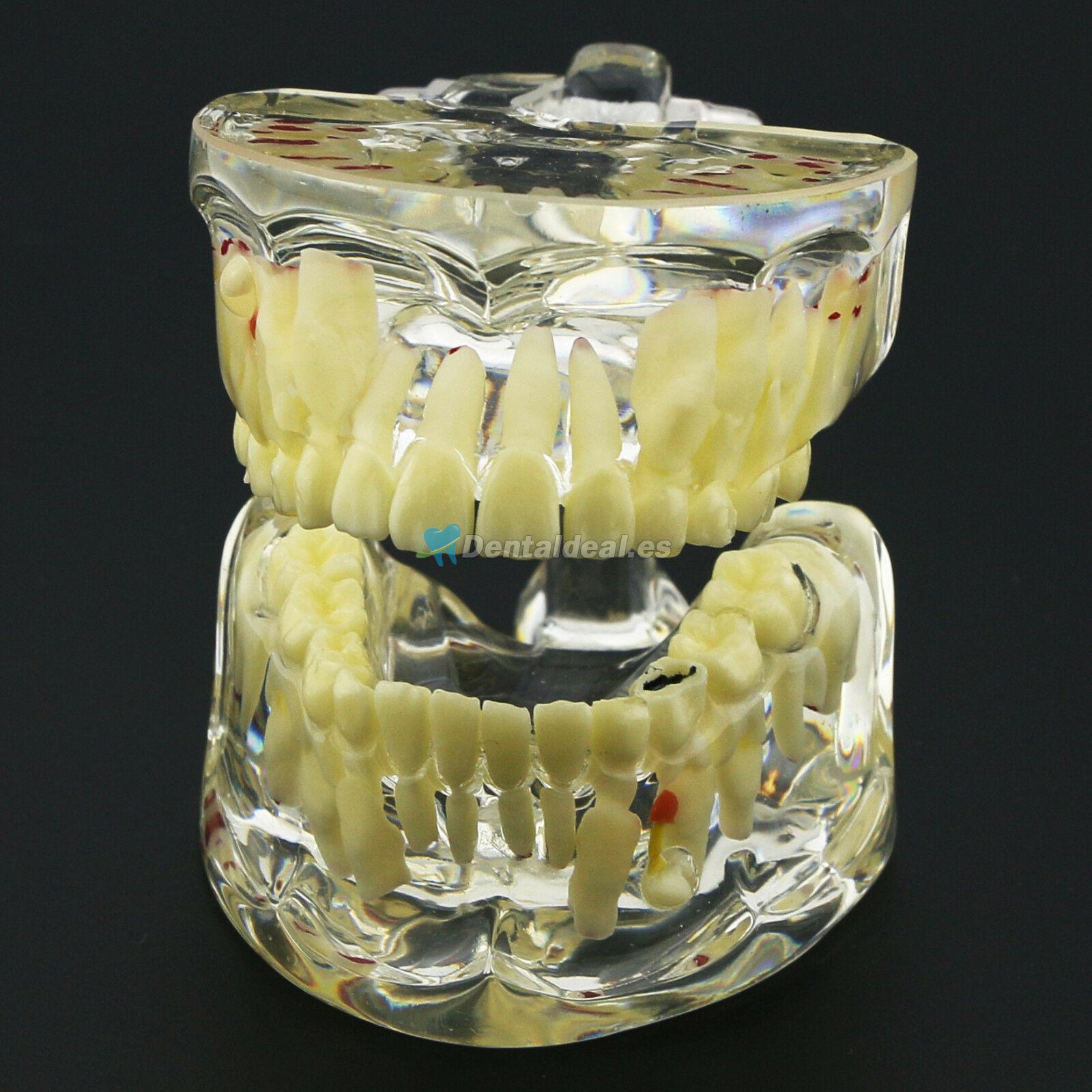 Modelo de Estudio de Demostración de Patología Pediátrica de Dientes de Niños Dentales 4002