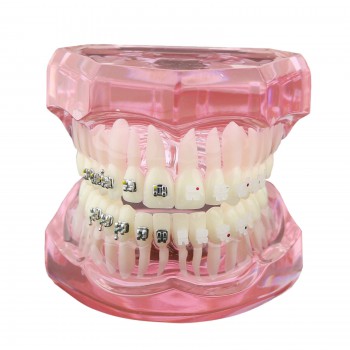 Dientes de ortodoncia dental Modelo de metal y soporte de cerámica Braces estudio modelo 3003