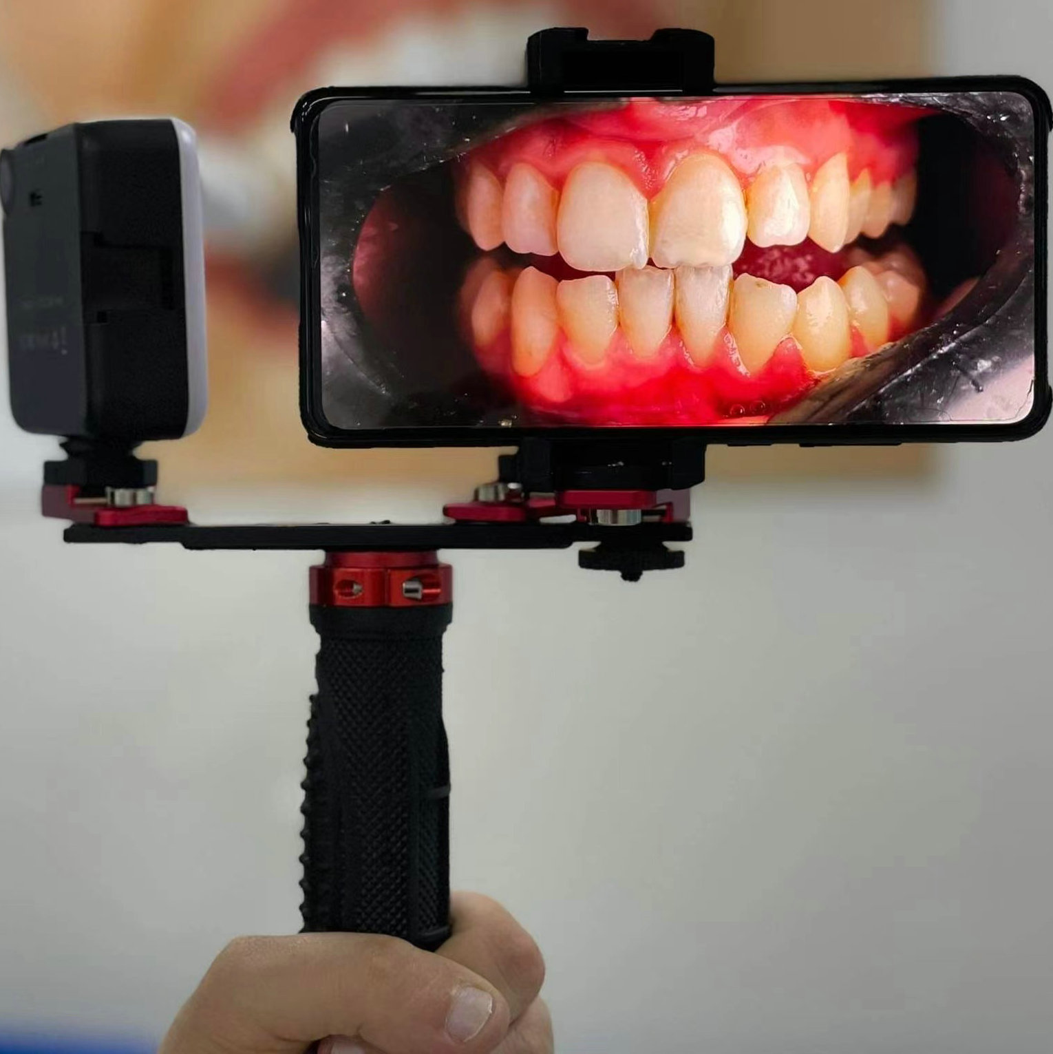 Lampara de fotografía oral dental teléfono móvil Fotografía dental luz de relleno Luz de flash