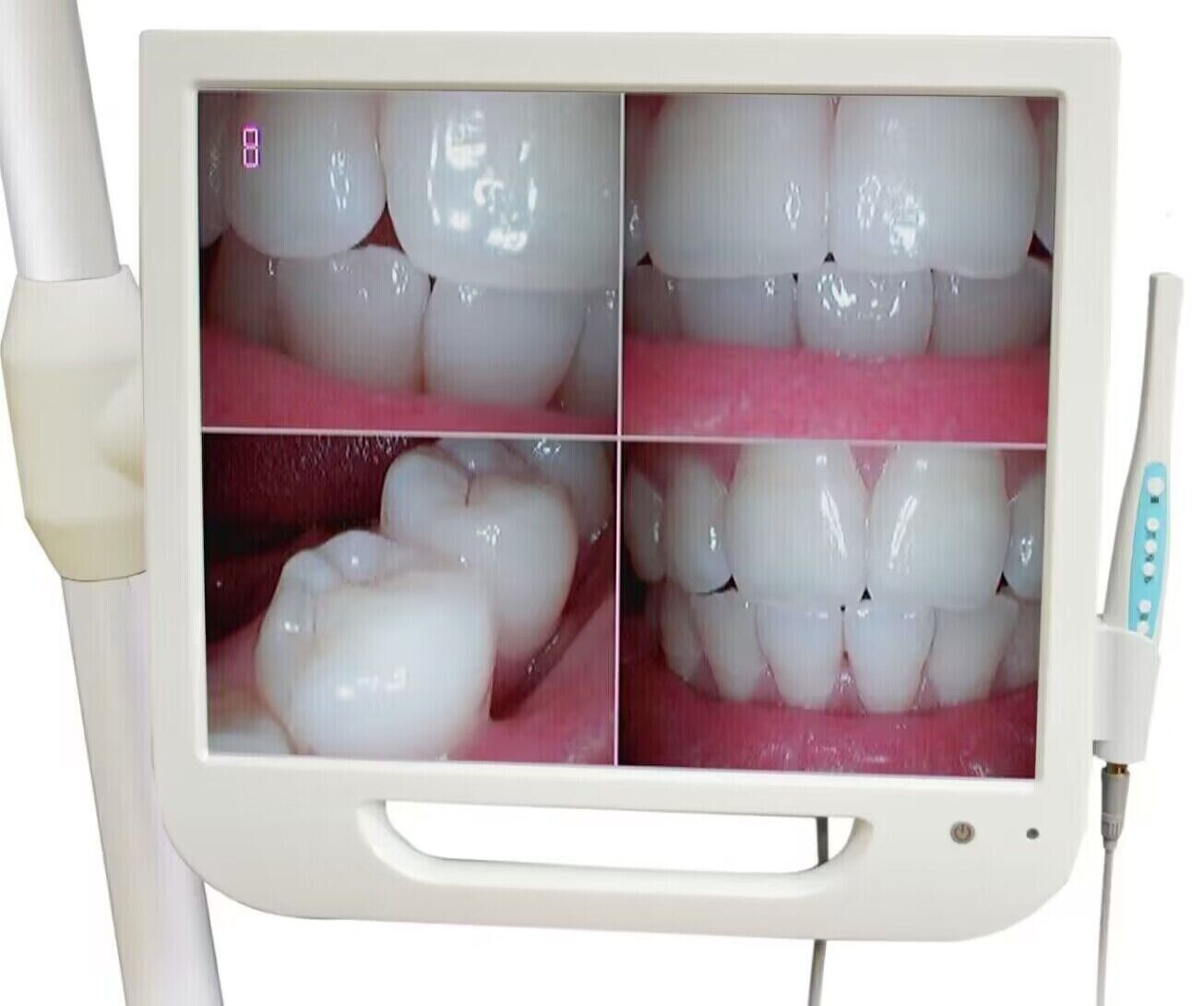 Cámara intraoral dental con monitor AIO LCD digital de alta definición de 17 pulgadas