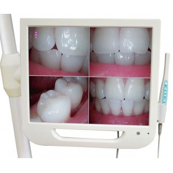 Cámara intraoral dental con monitor AIO LCD digital de alta definición de 17 pulgadas