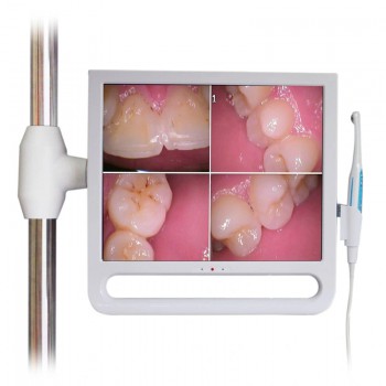 YF1700M Cámara intraoral dental de 17 pulgadas con monitor y soporte 1024*768 píxeles