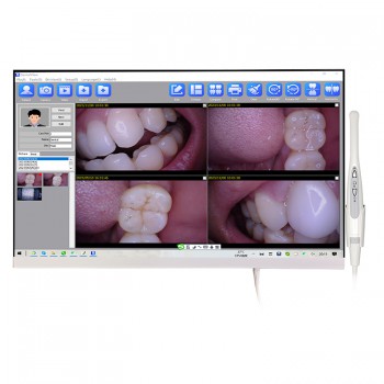 Magenta YF-2400P Cámara intraoral con pantalla táctil de 24 pulgadas con monitor LCD y función Wifi