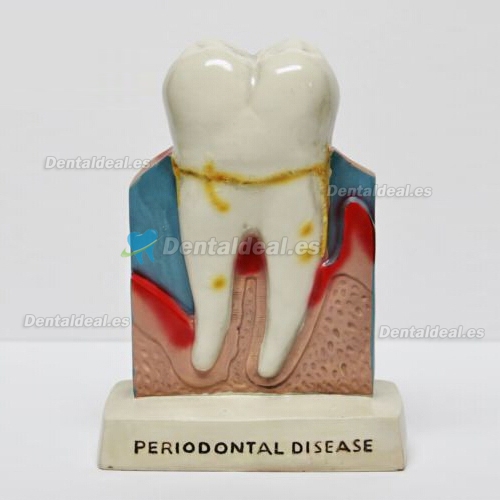 Dentist Dientes Oral Anatomía Enseñanza hospedándonos Decoración Modelo Figura