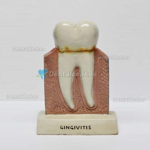 Dentist Dientes Oral Anatomía Enseñanza hospedándonos Decoración Modelo Figura