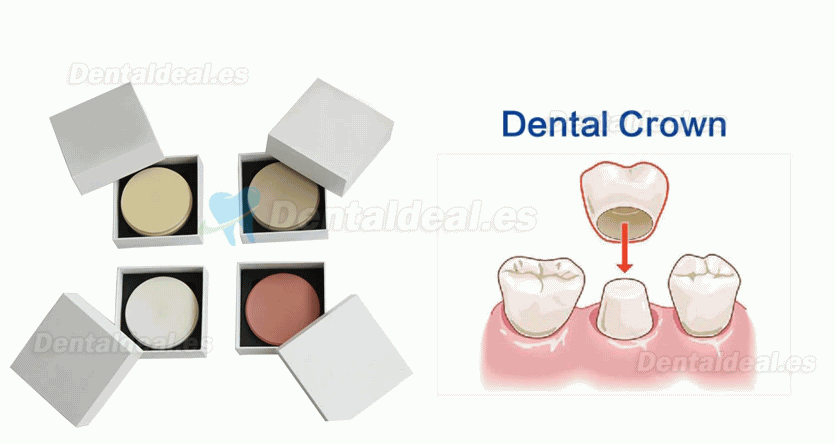 Bloques dentales PEEK para implante de prótesis dentales disco PEEK 98mm 95mm 12/14/16/18/20mm