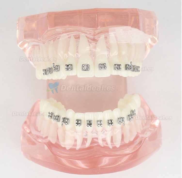 Modelo de Tratamiento de Ortodoncia Dental Dientes de Demostración con Soporte de Metal #3001