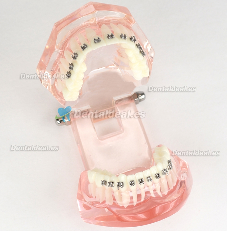 Modelo de Tratamiento de Ortodoncia Dental Dientes de Demostración con Soporte de Metal #3001