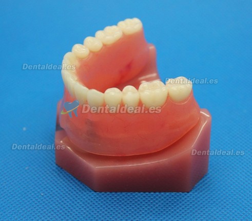 Dental Impant Modelo Para Reparación M-6007