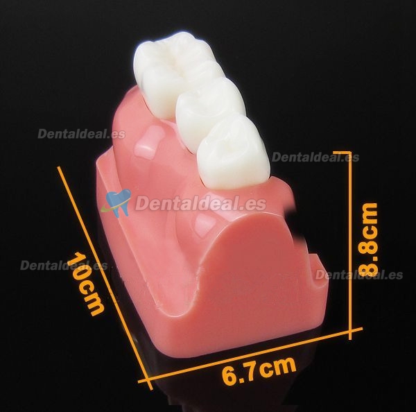 Analysis Modelo Para Dental Implant M2017