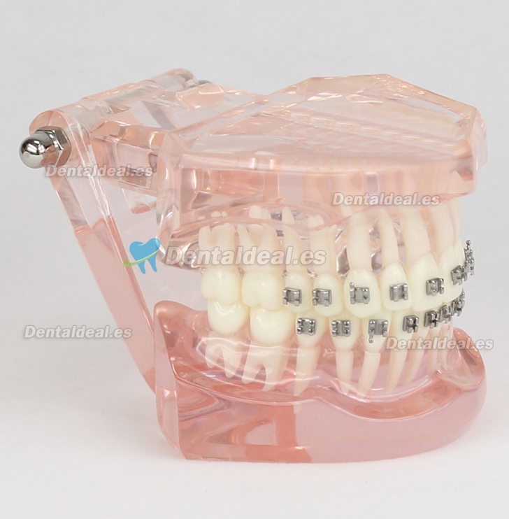 Modelo de Tratamiento de Ortodoncia Dental Dientes de Demostración con Soporte de Metal #3001