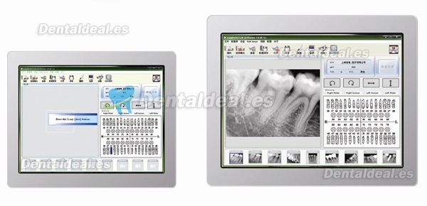 Dental Digital Dental Máquina Sensor Con Cable de conexión USB