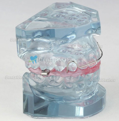 Orthodontic Demonstration Modelo Para Maintenance M3006
