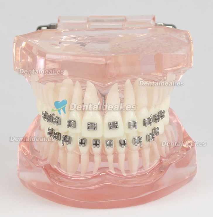 Modelo de Tratamiento de Ortodoncia Dental Dientes de Demostración con Soporte de Metal #3001