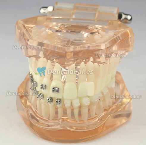 Dental Orthodontic Modelo Con Brackets M3009