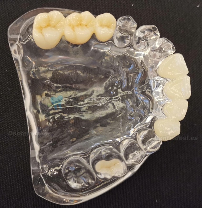 1 Uds Bloque de circonio multicapa para laboratorio Dental 3D bloque de cerámica CAD/CAM