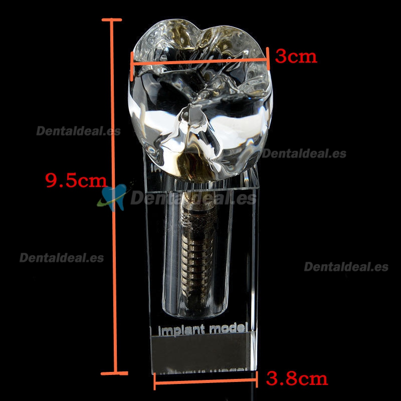 Dental Implant Crystal Modelo M2019-II