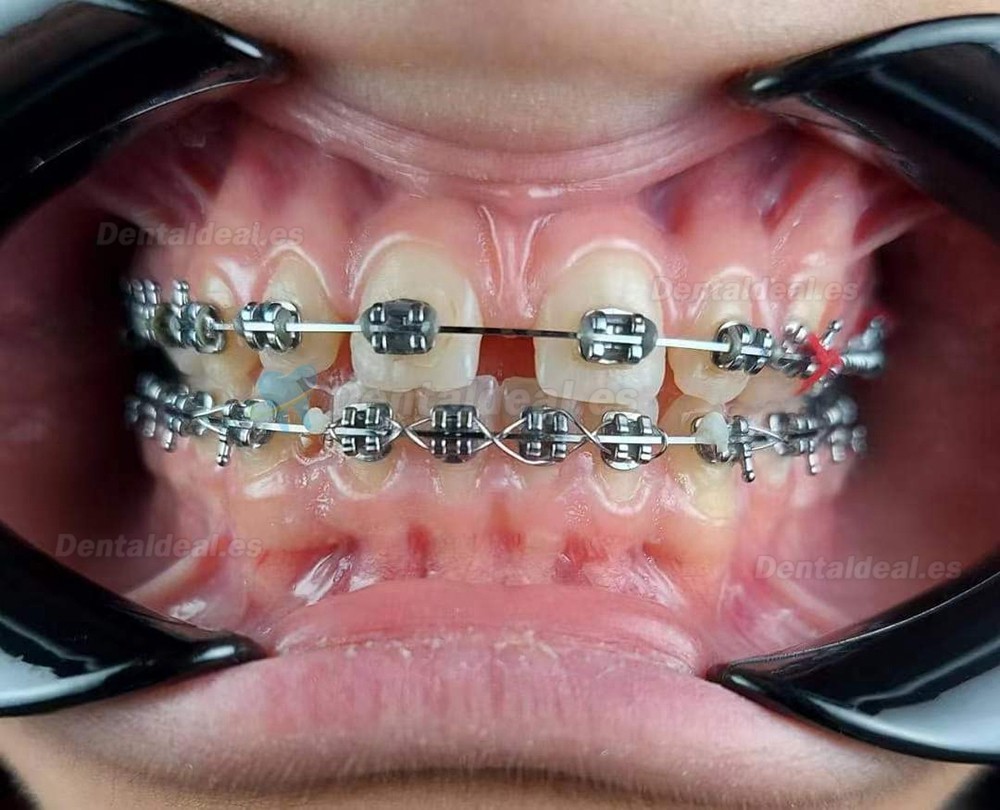 Lampara de fotografía oral dental teléfono móvil Fotografía dental luz de relleno Luz de flash