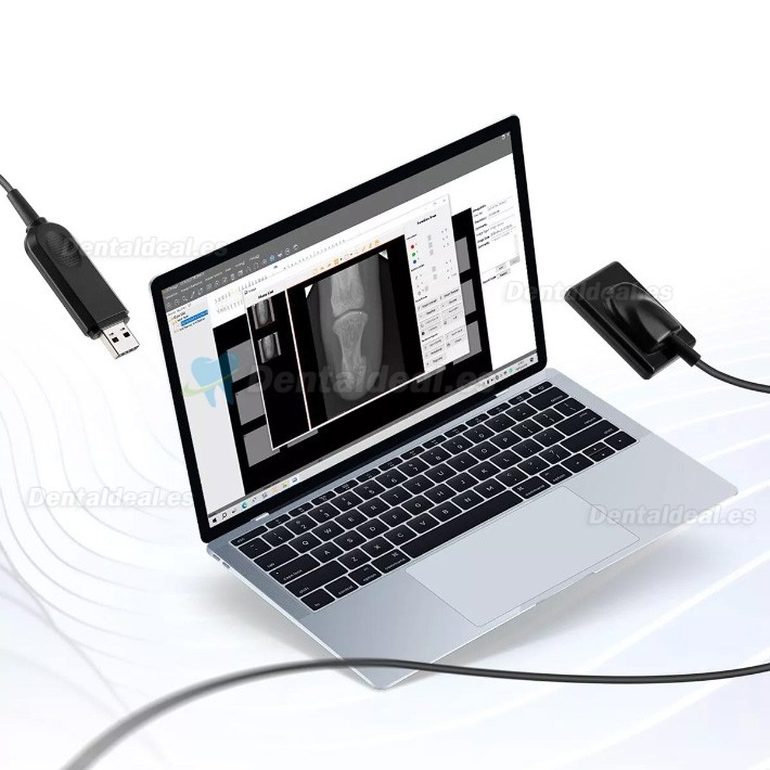 Sistema de radiografía dental portátil con kit de sensor de rayos X intraoral RVG