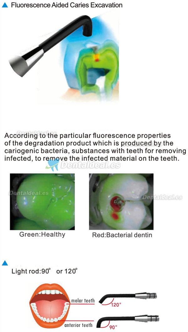 Dental Caries Detector Detección De Caries C-Hunter