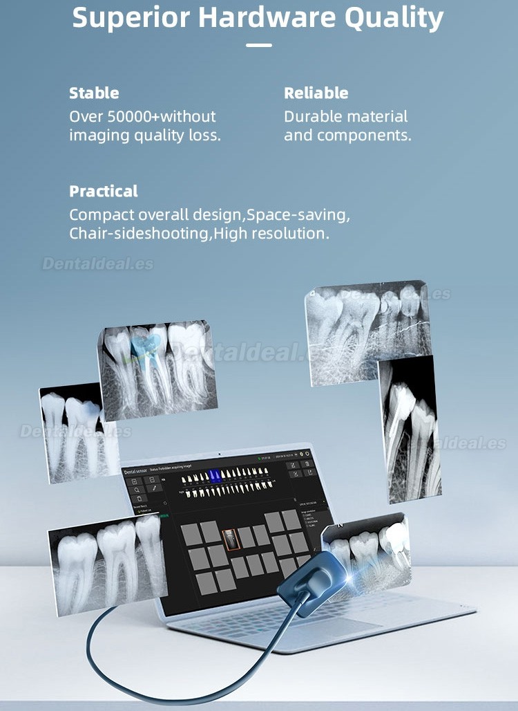 Sensor de rayos X digital dental RVG sistema de sensor intraoral S1/S2