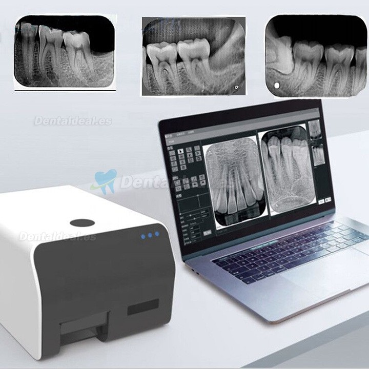 VRN Escáner de imágenes digitales PSP sistema de escáner de placa de fósforo dental