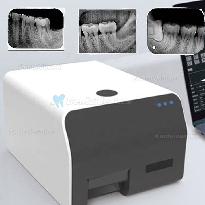 VRN Escáner de imágenes digitales PSP sistema de escáner de placa de fósforo dental