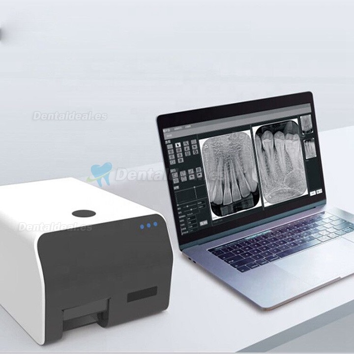 VRN Escáner de imágenes digitales PSP sistema de escáner de placa de fósforo dental