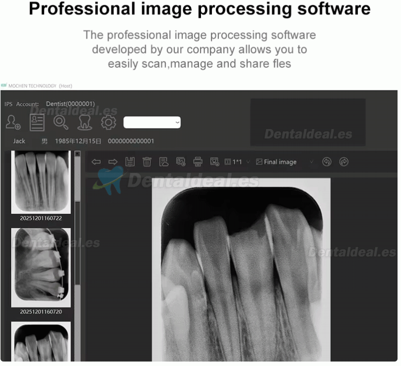 Handy IPS3 Esc&aacute;ner PSP Dental de Radiograf&iacute;a Digital M&aacute;quina de Escaneo de Imagen