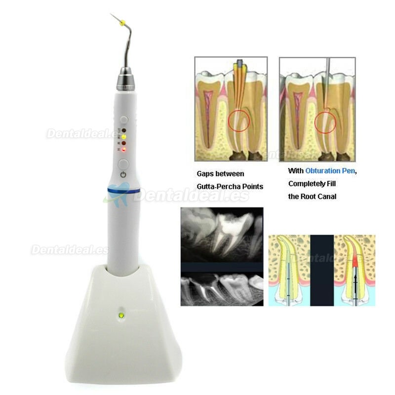 Dental Wireless Gutapercha Obturación Endodoncia Stylo chauffé Endodoncia