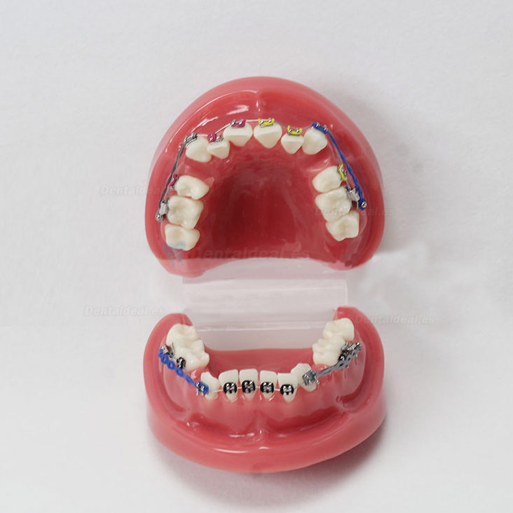 Modelo de ortodoncia con arco externo M-3005