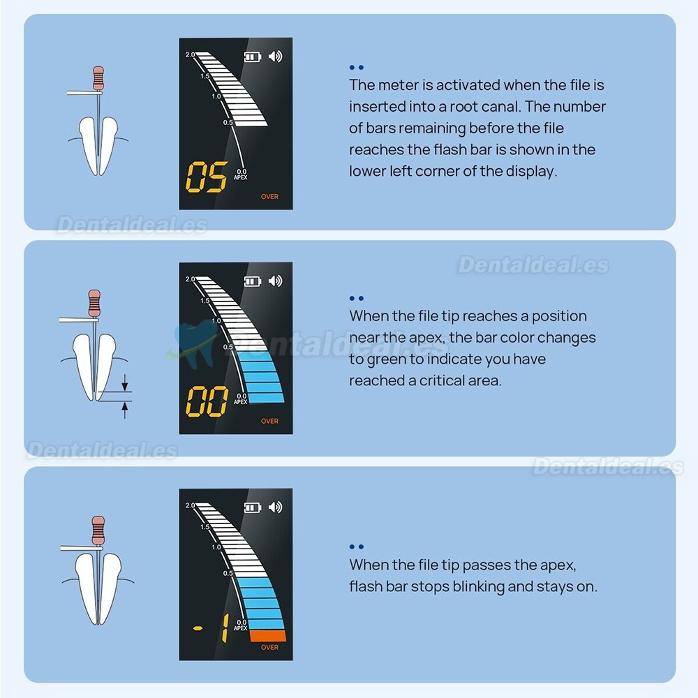 Micropex Pro Localizador de ápice endodoncia detector de conductos radiculares