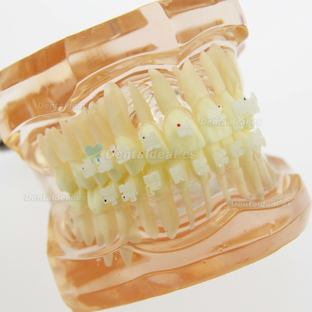 Modelo de Tratamiento de Ortodoncia Dental Dientes de Demostración con Soporte de Cerámica #3002