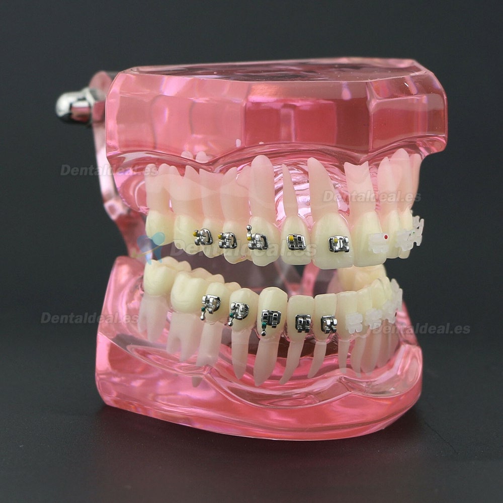 Dientes de ortodoncia dental Modelo de metal y soporte de cerámica Braces estudio modelo 3003