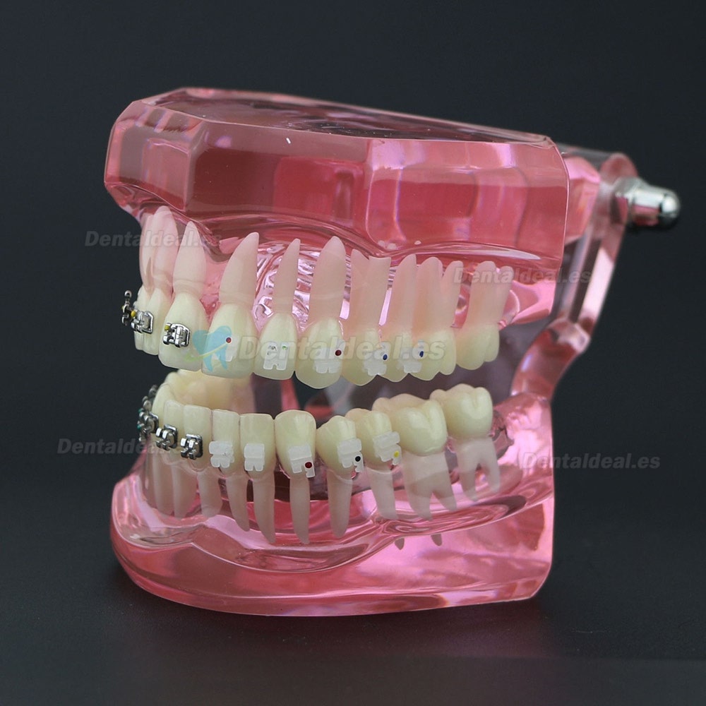 Dientes de ortodoncia dental Modelo de metal y soporte de cerámica Braces estudio modelo 3003