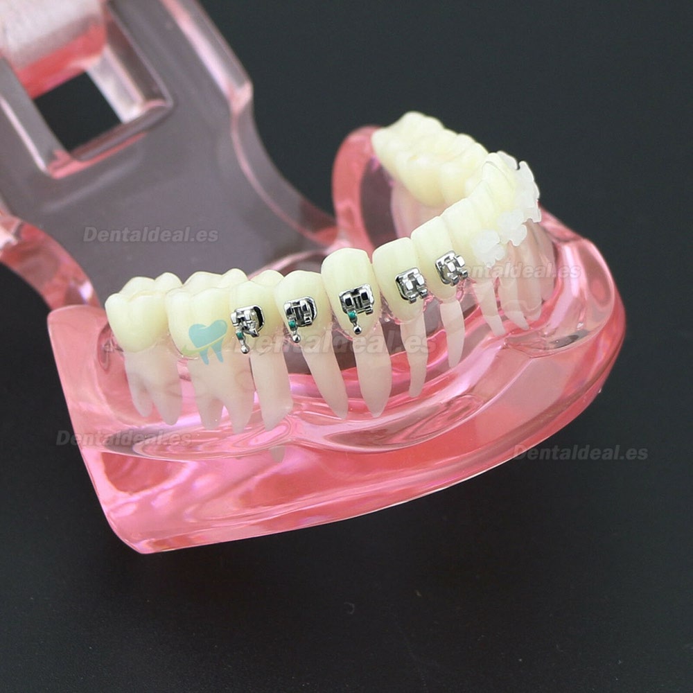 Dientes de ortodoncia dental Modelo de metal y soporte de cerámica Braces estudio modelo 3003