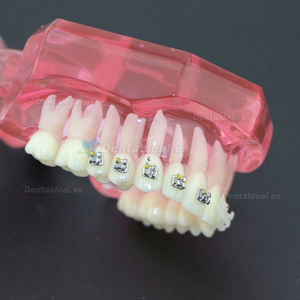 Dientes de ortodoncia dental Modelo de metal y soporte de cerámica Braces estudio modelo 3003